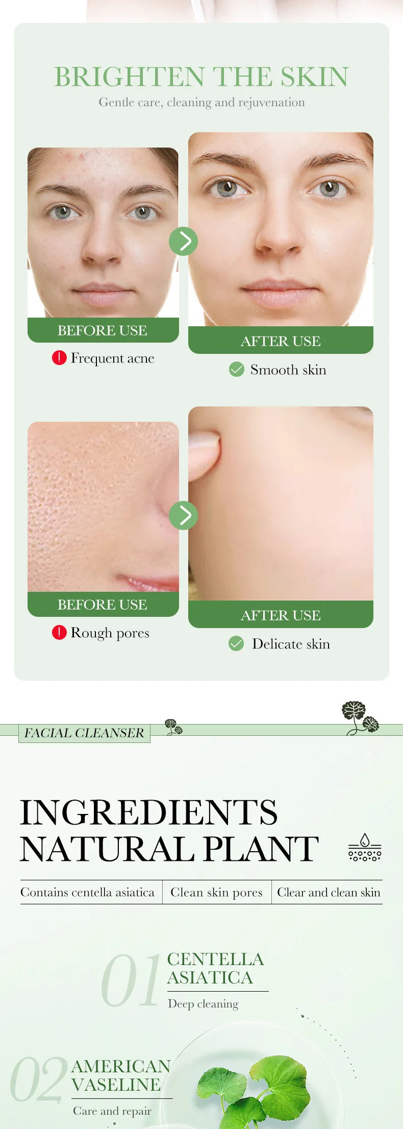 Limpiador Facial Centella Asiática – Espuma Calmante Anti-Inflamatoria