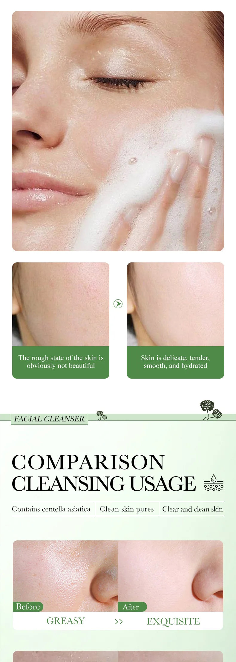 Limpiador Facial Centella Asiática – Espuma Calmante Anti-Inflamatoria