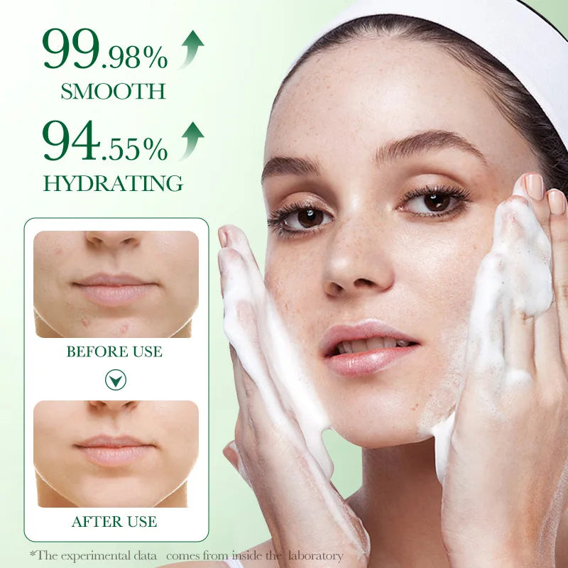 Limpiador Facial Centella Asiática – Espuma Calmante Anti-Inflamatoria